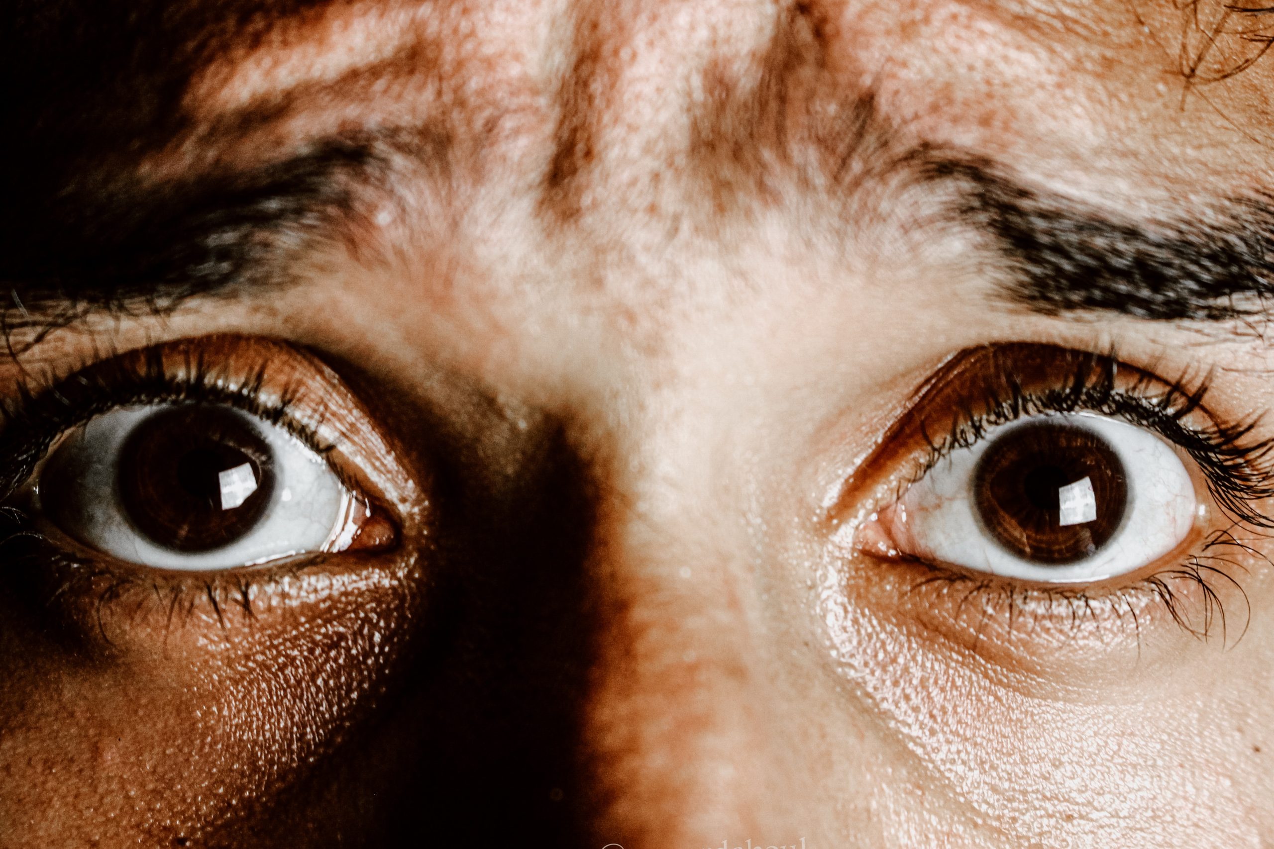 Gros plan visage yeux anxiété peur - Thérapie Delannoy